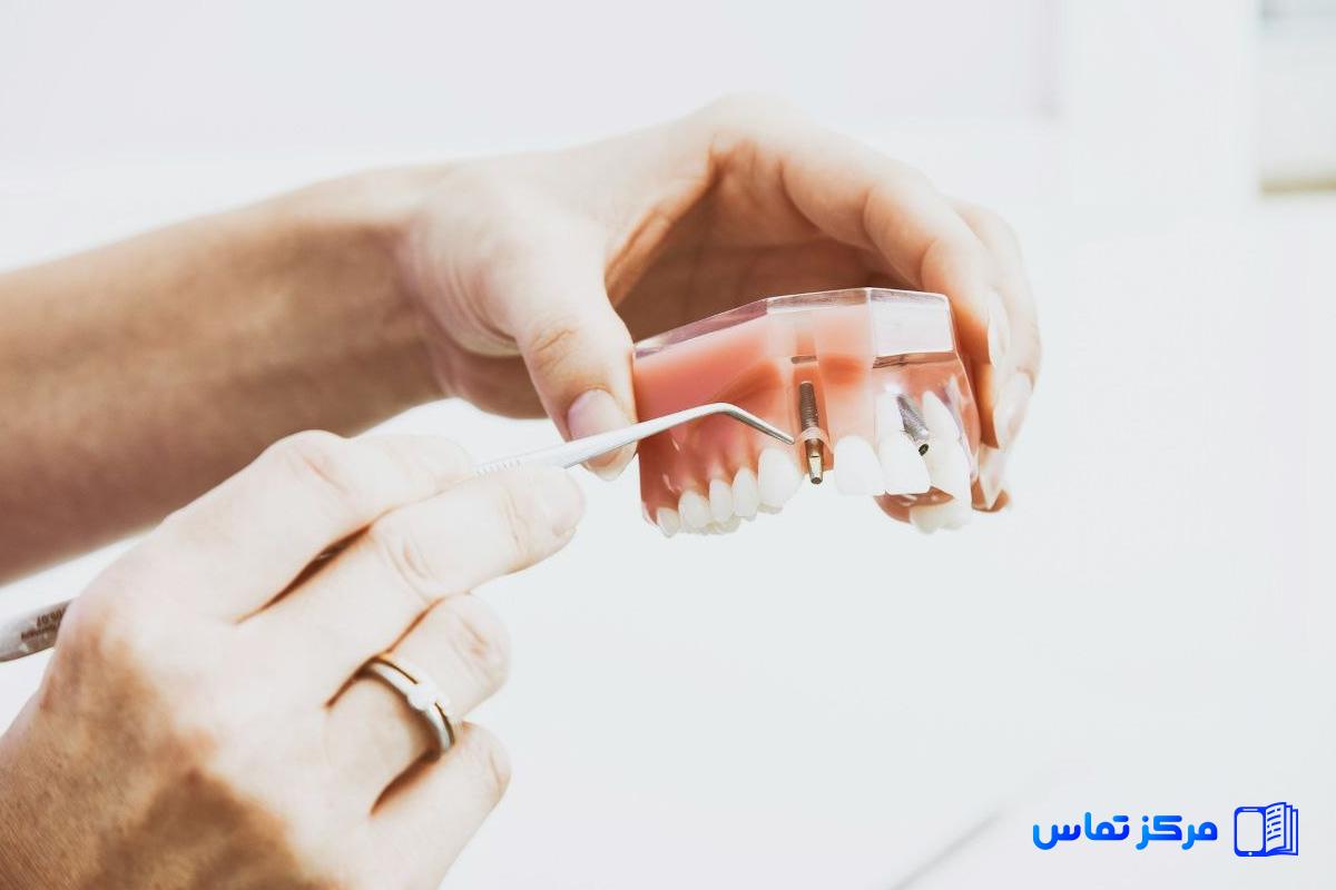 استخدام دندانساز در کشور ترکیه شهر استانبول